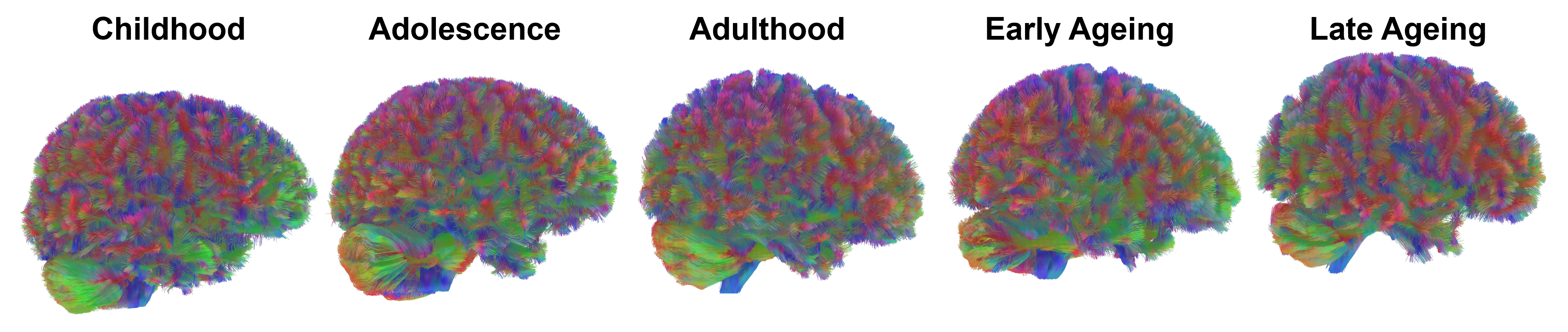 9시, 32시, 66시, 83시에 뇌가 변합니다